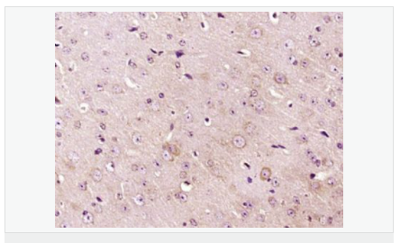 60583a84333ca.png image.png