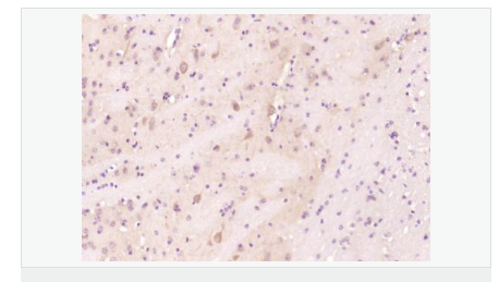 60612e573ec32.png image.png