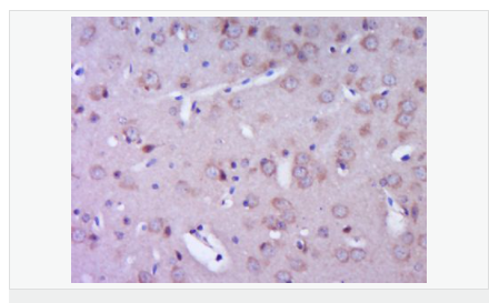 60616efee5aca.png image.png