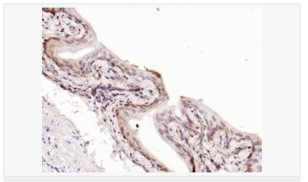 6066adc11c786.png image.png