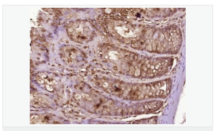 6066ca980344b.png image.png