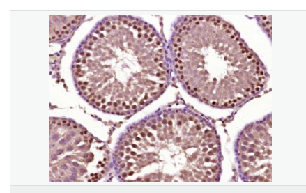 60764638e35ce.png image.png