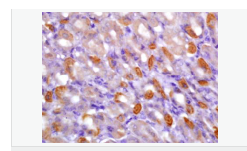 6077af977f399.png image.png